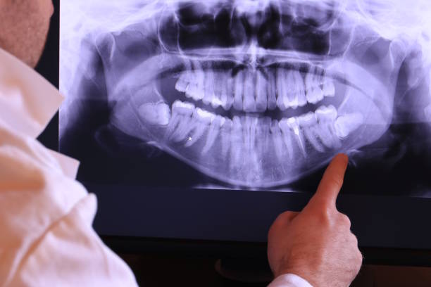 Best Urgent Dental Care for Toothache in Spiro, OK