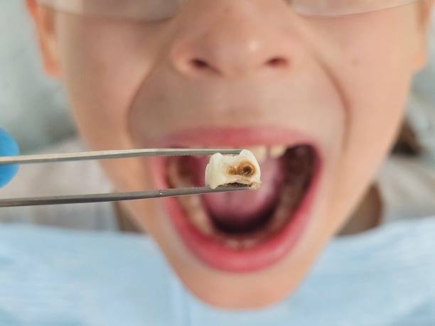 Best Pediatric Emergency Dentist in Spiro, OK